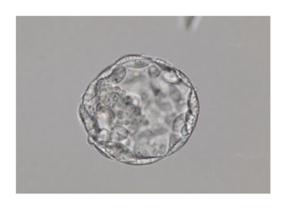 blastocyst1.jpg