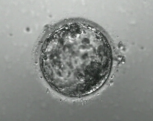 blastocystphoto.png
