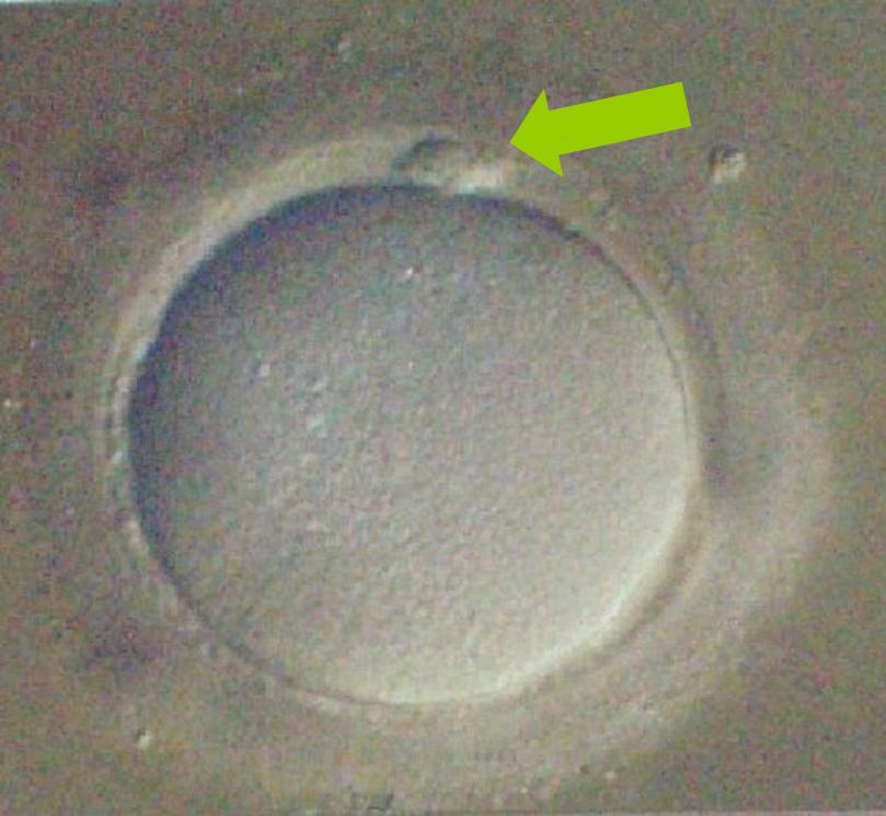 oocyte-m2.jpg